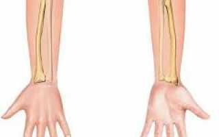 Перелом предплечья: причины, виды и особенности лечения