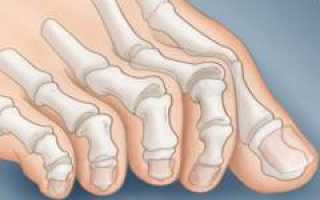Болят пальцы ног: причины, патологии и помощь при болях в пальцах ног