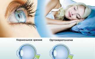 Контактные линзы ночного ношения — за и против, мнение экспертов