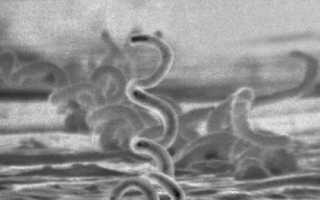 Сифилис — причины, симптомы, современная диагностика и лечение болезни, важные аспекты