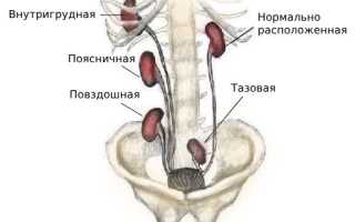 Ротация почки что это такое