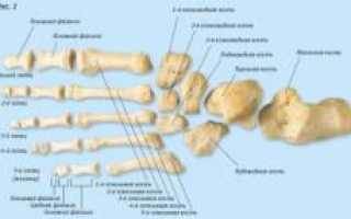 Шишки на ногах. Шишки на пальцах ног. Причины, диагностика, лечение и профилактика здоровья