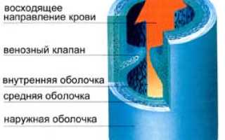 Варикозное расширение вен — варикоз. Причины, факторы риска, диагностика, эффективное лечение болезни и профилактика.