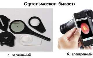 Метод офтальмоскопии при обследовании органов зрения: важные аспекты и преимущества