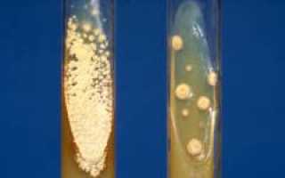 Гистоплазмоз. Причины, симптомы, диагностика и лечение патологии у человека.