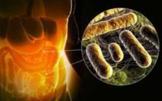 Пищевое отравление: симптомы, лечение и профилактика для здоровья.