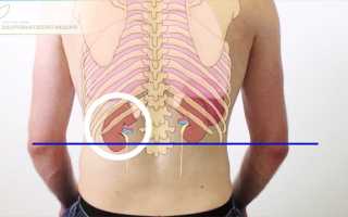 Боль в почках. Как найти причину по косвенным признакам и устранить?