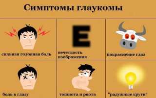 12 правил профилактики глаукомы для здоровья глаз