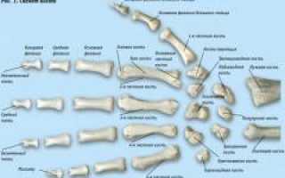 Артроз кисти и пальцев рук. Причины, симптомы, диагностика и лечение артроза: полное руководство