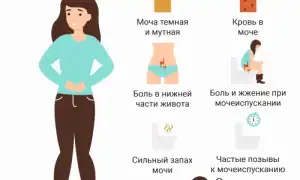 Пиелоцистит симптомы