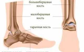 Подвернул ногу. Механизм повреждения, симптомы, диагностика повреждения и лечение травмы.