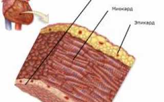 Миокардит. Причины, симптомы и признаки, диагностика и лечение болезни у пациентов