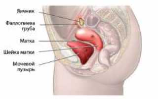 Непроходимость маточных труб: причины, симптомы и признаки, диагностика и лечение болезни, а также рекомендации специалистов.