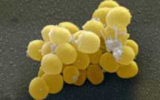 Стафилококк. Обнаружен стафилококк в носу, горле, зеве, на коже, что делать? Золотистый стафилококк у грудных детей. Как выявить и лечить инфекцию? Полезные советы и рекомендации