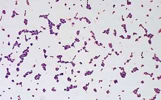 Косметика с бактериофагами: что это такое и чем она полезна для кожи?