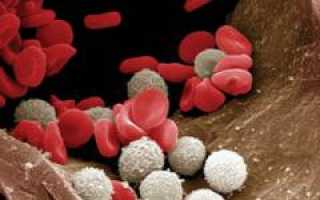 Лимфогранулематоз (болезнь Ходжкина) – причины, симптомы, диагностика, лечение и прогноз для пациентов