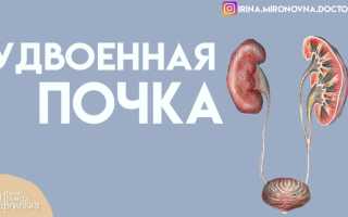Удвоенная почка что это такое