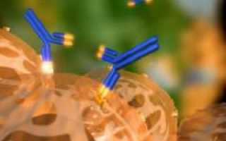 Ревматическая лихорадка. Причины, симптомы, признаки, диагностика и лечение патологии у детей