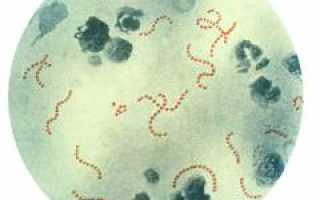 Стрептококк. Обнаружен стрептококк в носу, горле, зеве, на коже, что делать? Стрептококк у грудных детей. Как выявить и лечить инфекцию правильно?