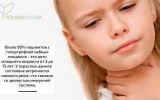 Гипертрофия небных миндалин. Причины, симптомы, диагностика и лечение патологии у детей
