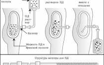 Виды диализа