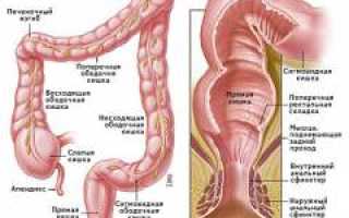 Трещина заднего прохода (анальная трещина) — причины, симптомы, диагностика и лечение патологии. Какие свечи и мази используются в лечении? Обзор методов и рекомендаций.