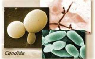 Кандидоз полости рта. Причины, симптомы и признаки, лечение кандидоза. Полное руководство
