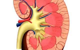 Гидронефроз. Причины, симптомы, диагностика и лечение заболевания у взрослых.