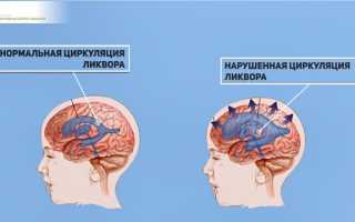 Болит голова: определяем причину и успокаиваем головную боль, советы и рекомендации
