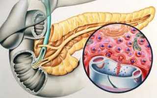 Хронический панкреатит — причины, факторы риска, симптомы, диагностика, осложнения, эффективное лечение и профилактика