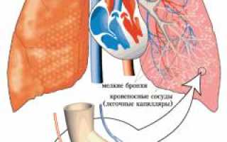 Эмфизема легкого. Причины, симптомы, признаки, диагностика и лечение патологии для здоровья.