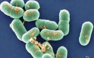 Листериоз. Причины, симптомы, диагностика и лечение патологии у людей.