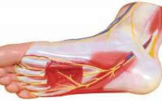 Болит пятка. Причины болей в пятке и их лечение