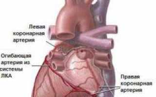 Инфаркт миокарда. Причины, симптомы, признаки, диагностика и лечение патологии у пациентов