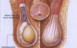 Орхит — симптомы, причины, диагностика и лечение заболевания. Хронический и острый орхит у мужчин