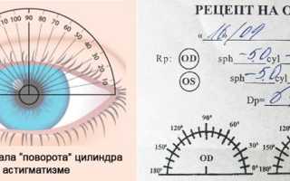 Методы лечения сложного астигматизма: эффективные подходы и рекомендации