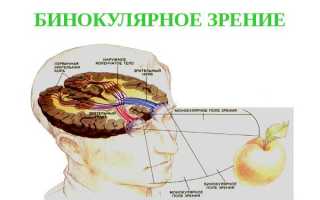 Причины и методы коррекции бинокулярного зрения для улучшения качества жизни
