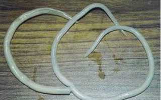 Аскаридоз — инфицирование, современная диагностика, лечение и профилактика болезни у людей