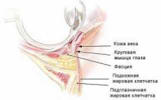Мешки под глазами. Причины патологии. Как убрать мешки под глазами в домашних условиях? Полезные советы и рекомендации.