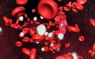 Аутоиммунная анемия: причины и лечение