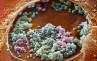 Хламидиоз. Как он передается, симптомы хламидиоза, современная диагностика, эффективное лечение заболевания и профилактика.