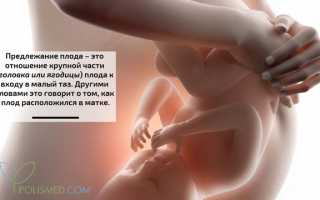 Предлежание плода. Классификация, причины, диагностика и осложнения в акушерстве