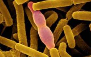 Сибирская язва. Причины, симптомы, диагностика и лечение патологии у людей