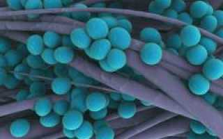 Сепсис. Причины, симптомы, признаки, диагностика и лечение патологии у пациентов