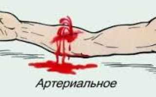 Кровотечение — как оказать помощь? Классификация, виды, наружное, внутреннее, артериальное, венозное, капиллярное, симптомы и признаки, способы остановки кровотечения, оказание первой помощи. Жгут при кровотечении: важные аспекты.