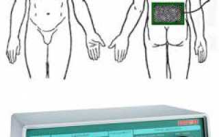 Электрофорез. Суть методики, показания, противопоказания и применение