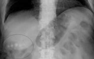 Болит живот справа. Виды болей в правой части живота. Диагностика и помощь при болях в животе справа. Полезные советы и рекомендации