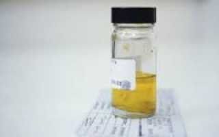 Анализ мочи по Нечипоренко — расшифровка. Норма эритроцитов, лейкоцитов и цилиндров, причины повышения значений показателей и их значение для здоровья