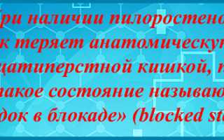 Пилоростеноз (стеноз привратника). Причин, симптомы, диагностика и лечение патологии у детей
