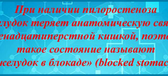 Пилоростеноз (стеноз привратника). Причин, симптомы, диагностика и лечение патологии у детей